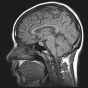 Мозговой имплант от DARPA позволит контролировать настроение