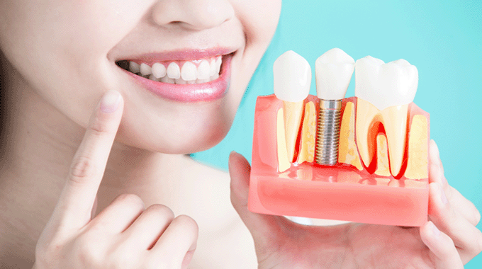 Искусство привлекательности: важность улыбки и методы восстановления зубов